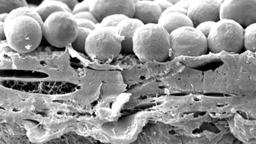 Microscope image