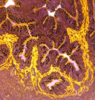 Picture of a Microorganism Observed From a Microscope